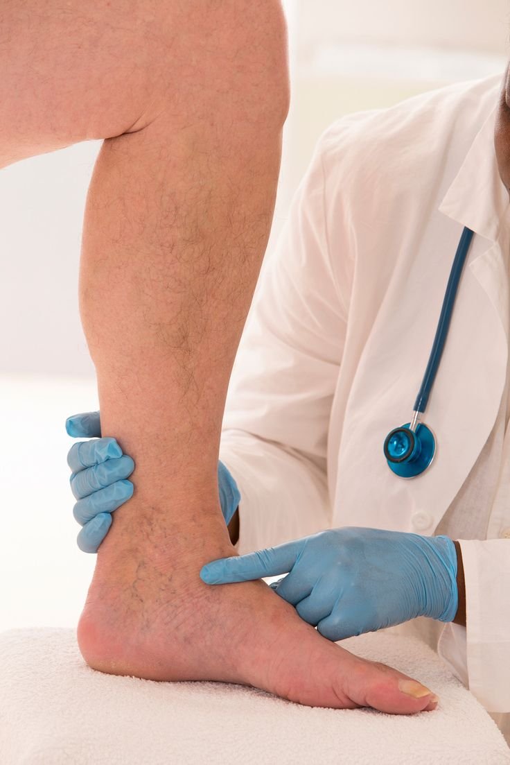 PVD, DVT & Varicose Vein Prevention